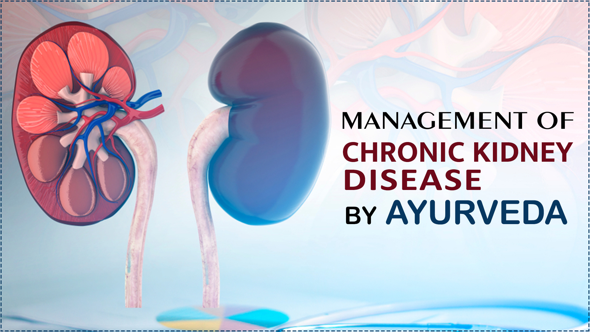 Management Of Chronic Kidney Disease By Ayurveda