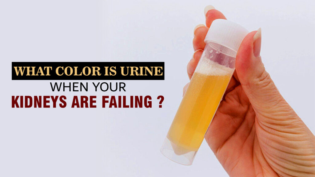 What Is The Color Of A Pregnancy Urine